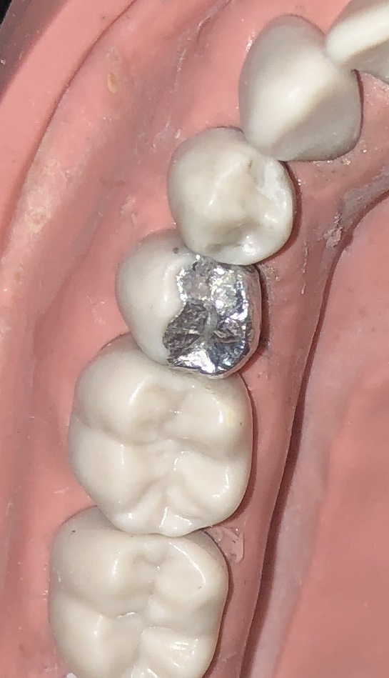 95947F0A-17D6-4256-B3E0-1CA60D11FB15