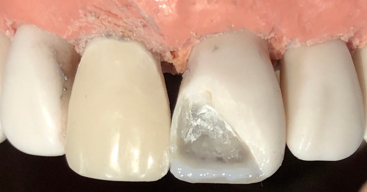 B70B8612-13E5-4267-92AA-7D0CD5C39237