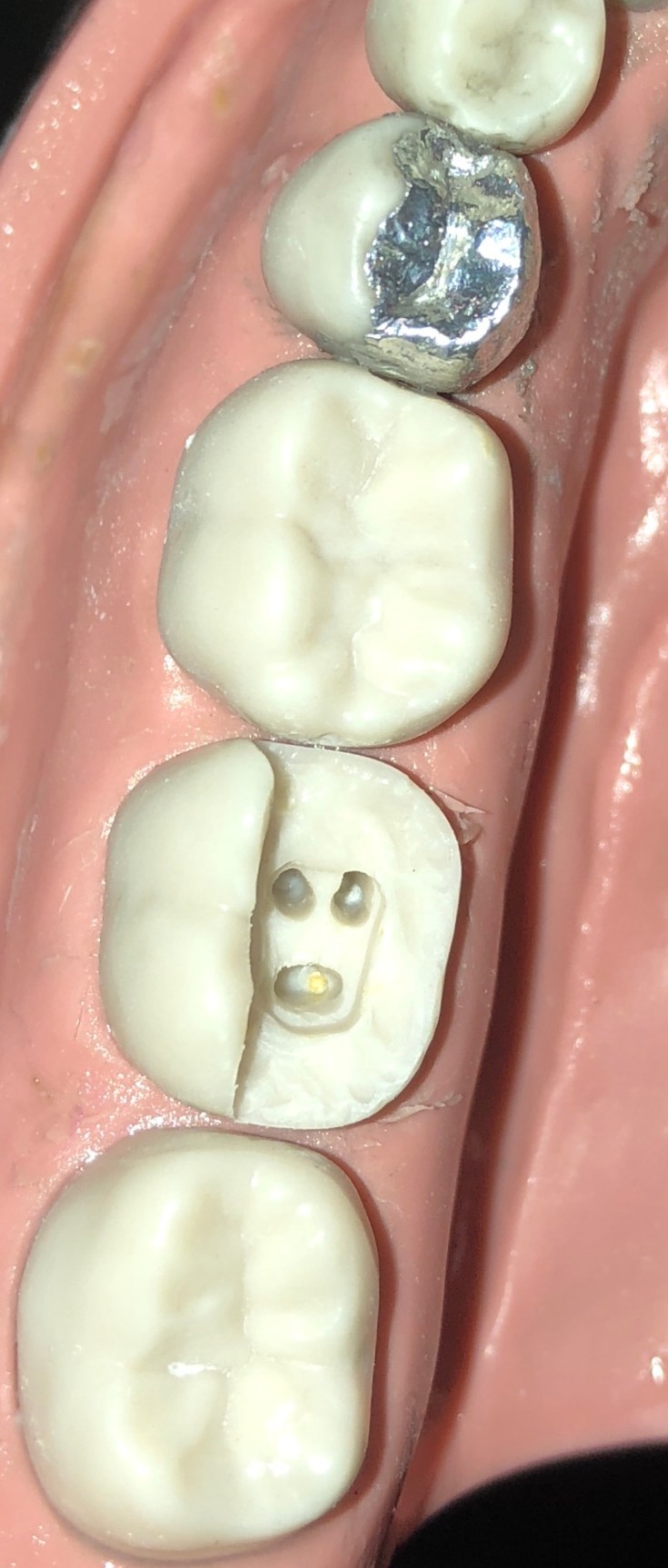 F0AA93A4-F549-4A13-8BF0-FF8A92698094