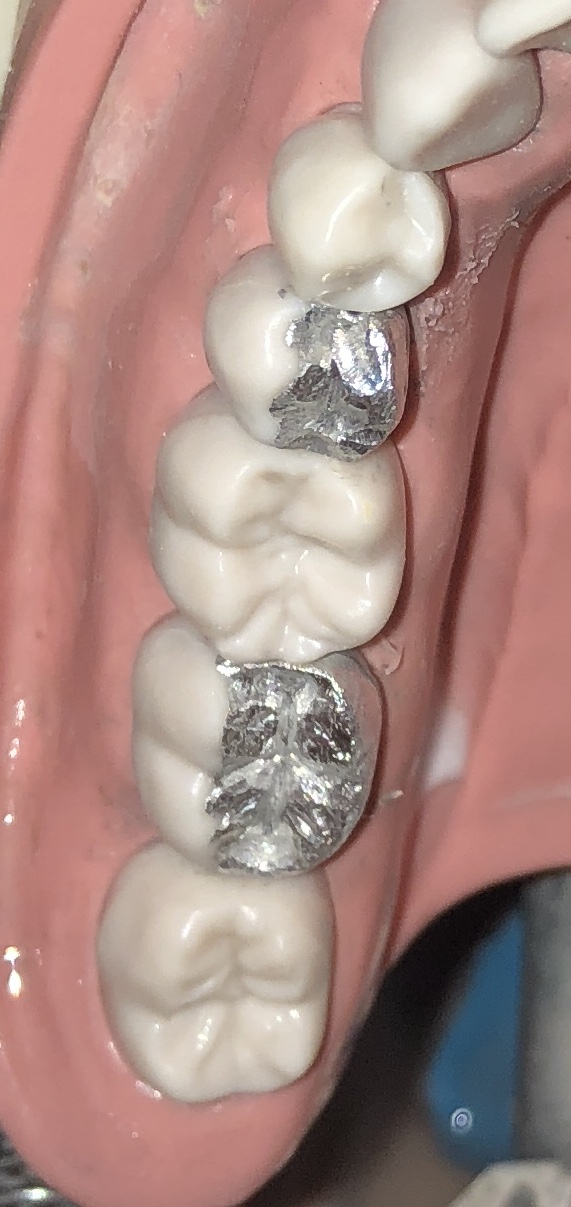 F1DF0308-0C54-4FC4-A85B-814E8024B54C